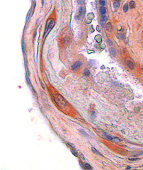 CSF1 in placenta